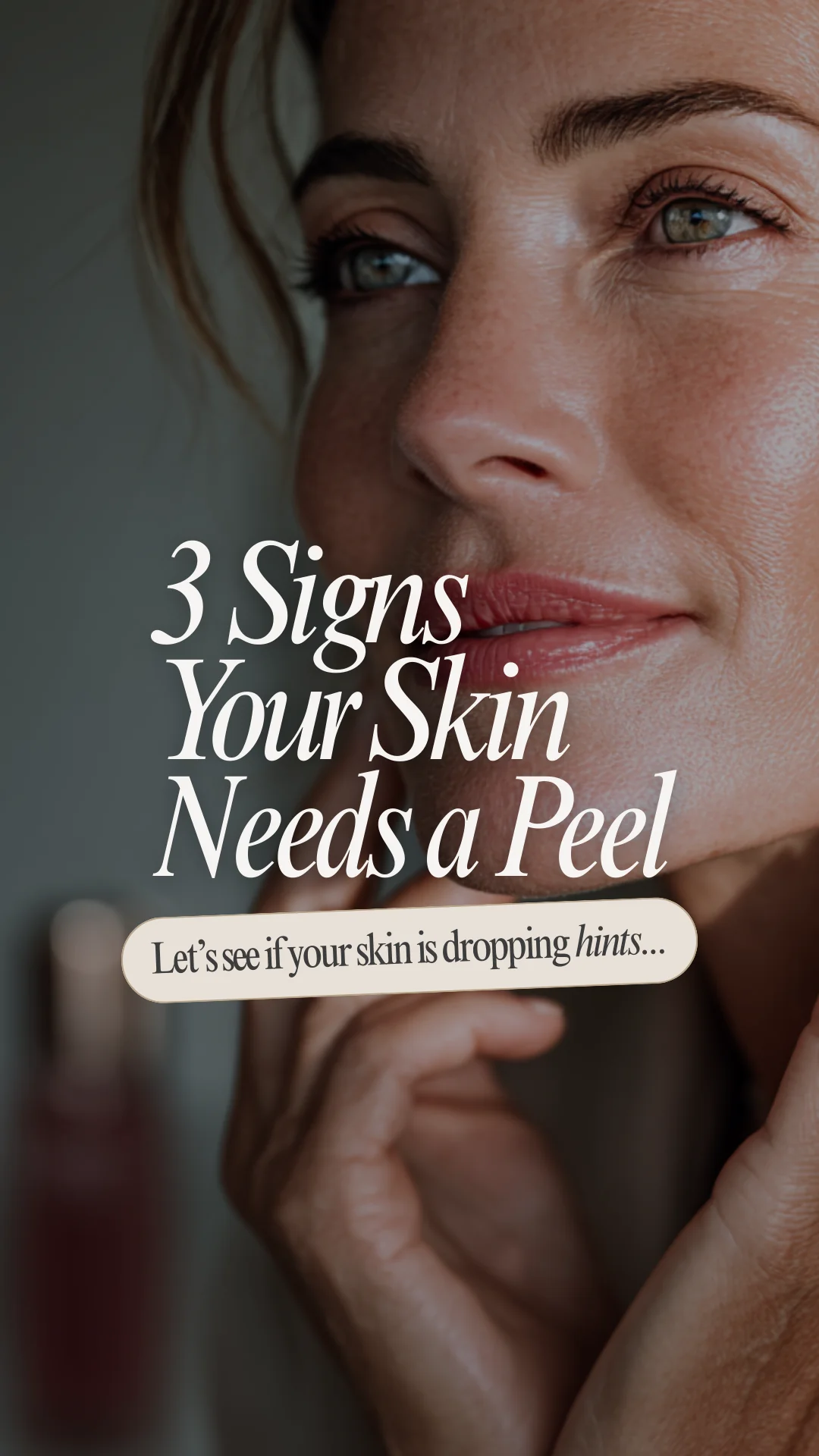 Esthetician template — 3 signs your skin needs a peel