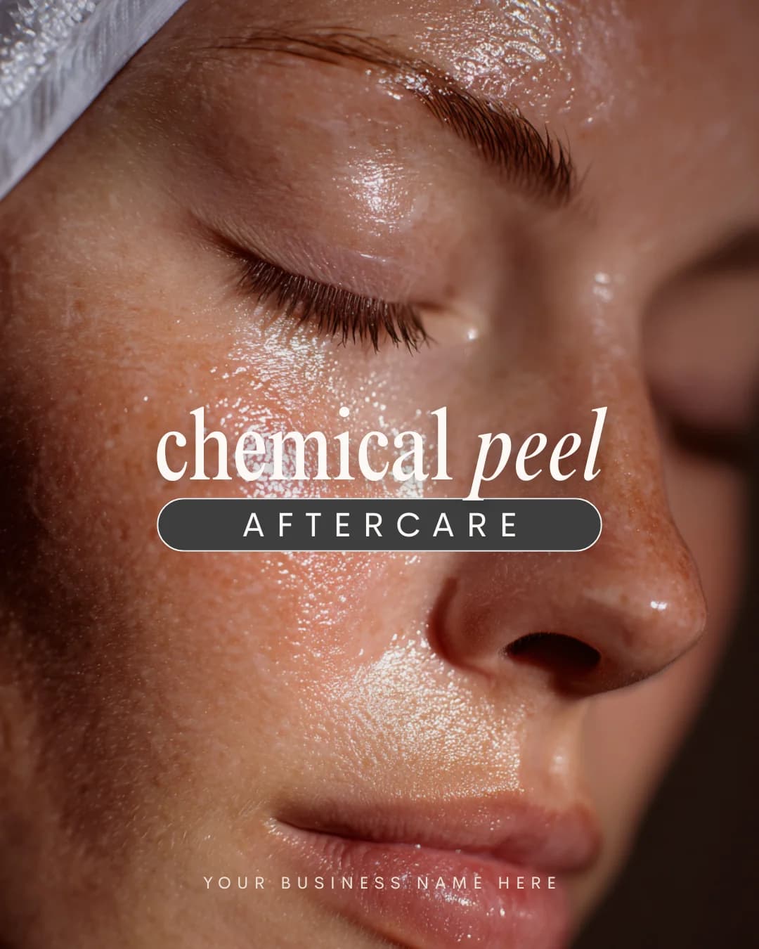 Esthetician template — chemical peel aftercare