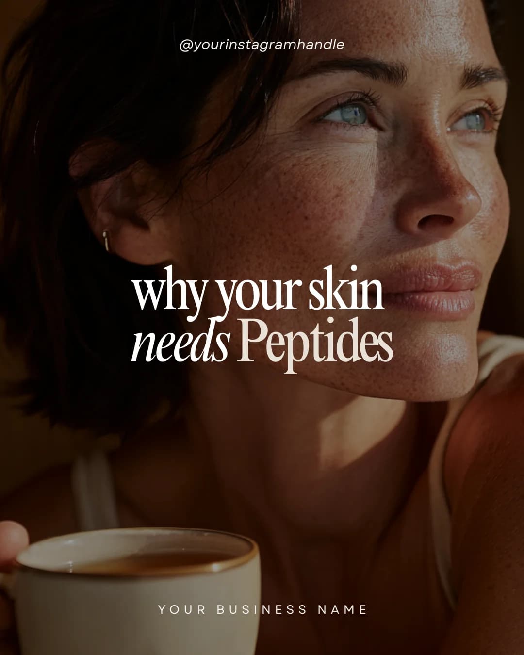 Esthetician template — why your skin needs peptides