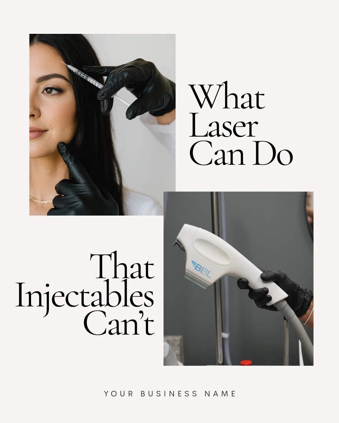 Med spa template — what laser can do that injectables cannot
