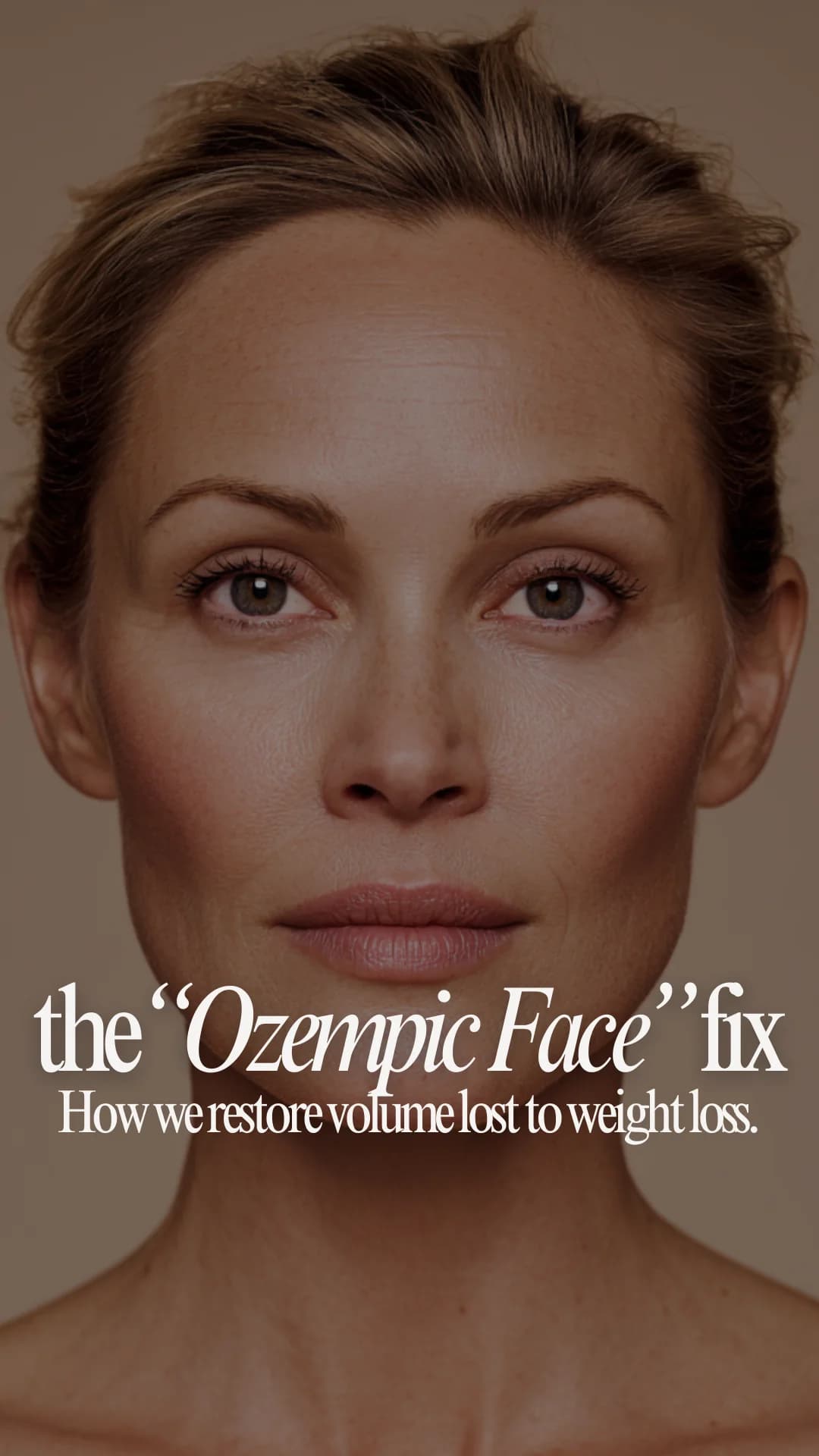 Injector template — restoring volume lost to weight loss