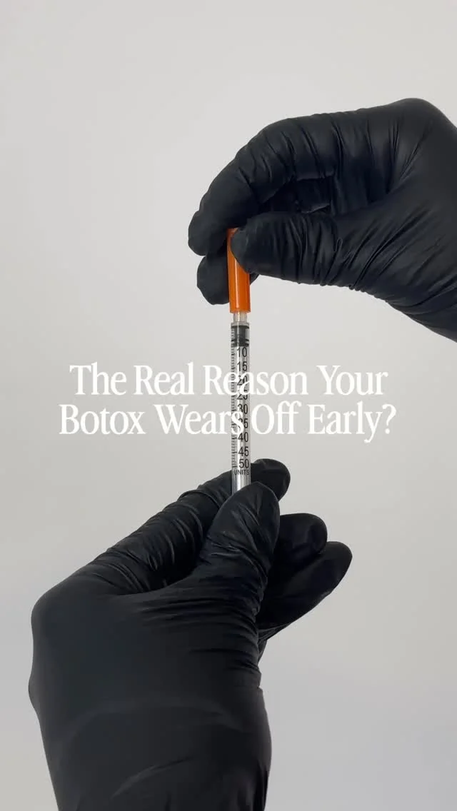 Injector template — the real reason your Botox wears off early